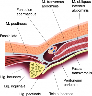 Anatomy - Lichtenstein Repair of Inguinal Hernia